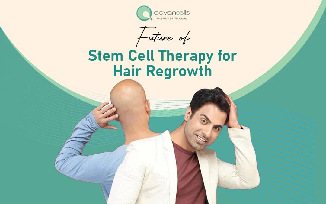 Future of Stem Cell Therapy for Hair Regrowth